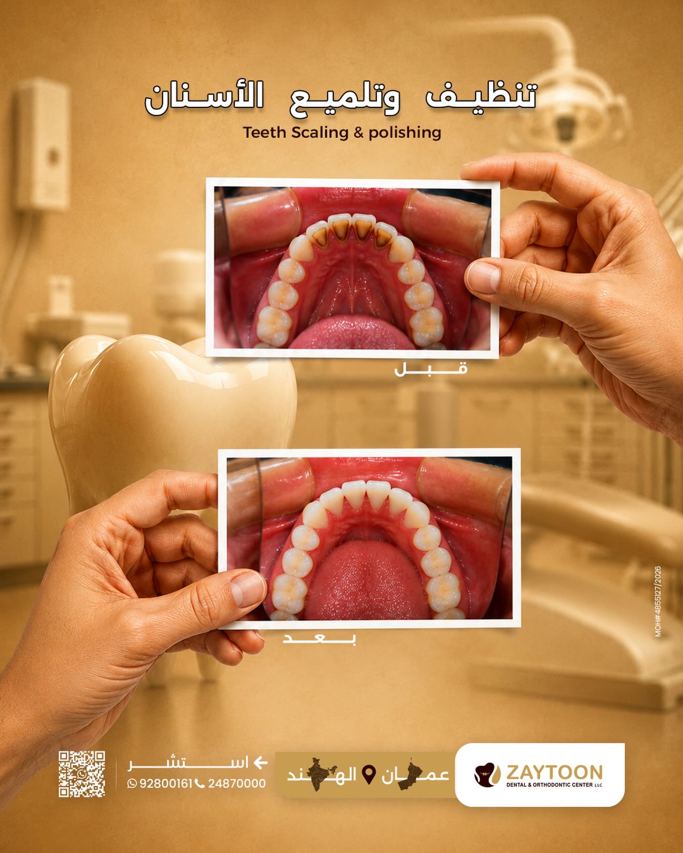 تنظيف وتلميع الأسنان